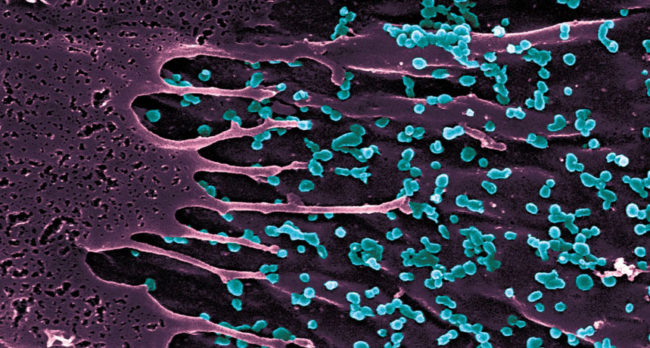 Chikungunya virus, transmitted by Aedes mosquitoes as seen under a microscope
