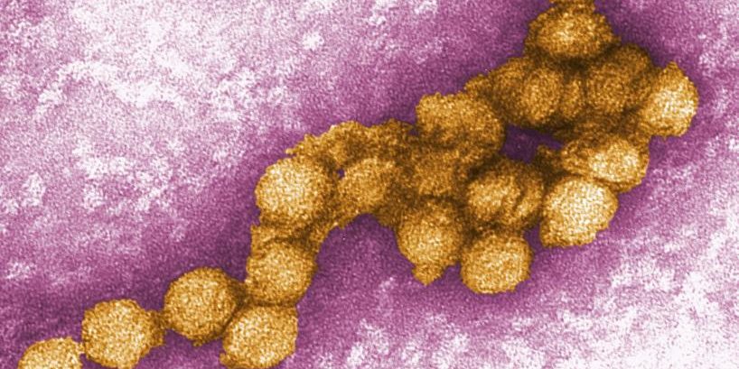 West Nile virus transmitted by mosquitoes as seen under a microscope